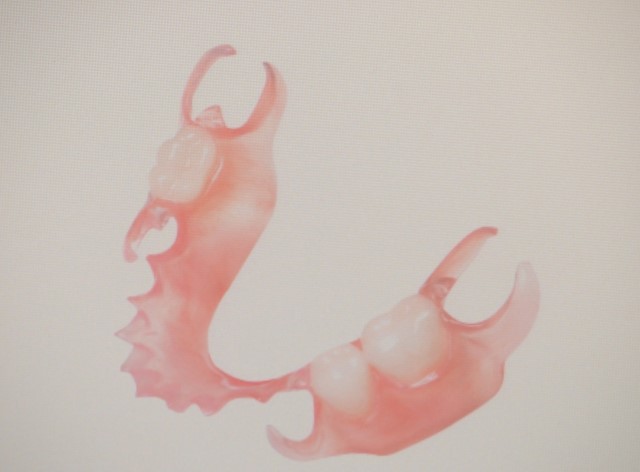 How To Make Dentures Step By Step Sandy Hook CT 6482